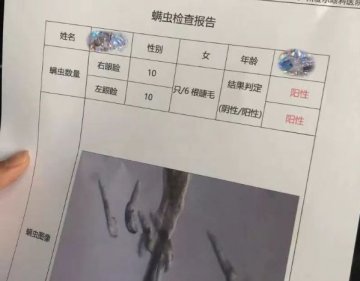 情侶分手因螨蟲和狗，吵架吵到朋友(yǒu)圈